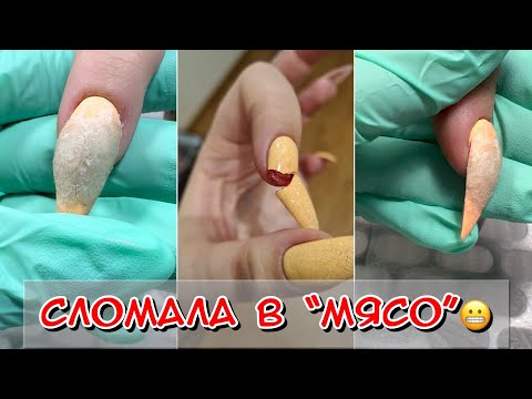 Видео: Сломала ноготь в мясо / Сломала ноготь / Сломала ноготь что делать  / Маникюр