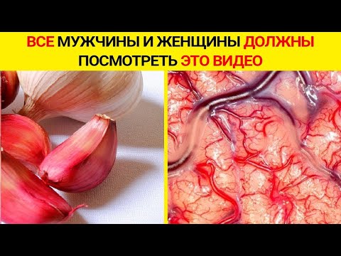 Видео: Принимайте Чеснок, но не Совершайте ОШИБКУ, Что Происходит, когда Вы Принимаете Сырой Чеснок...