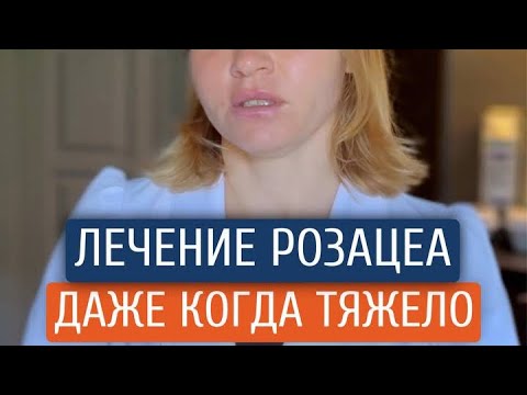 Видео: 😫Как лечить розацеа, когда обстоятельства, мягко говоря, не располагают #розацеа 