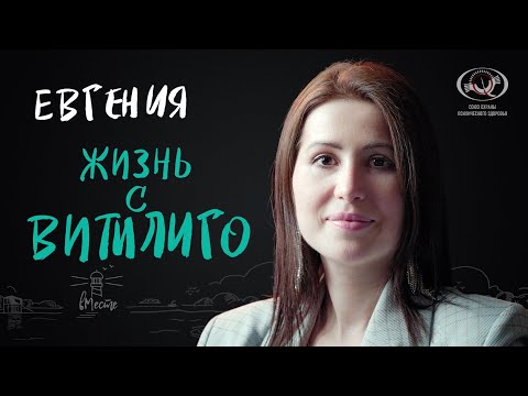 Видео: Евгения. Жизнь с витилиго. Интервью для вМесте