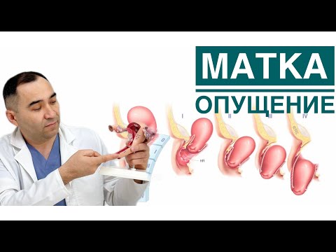 Видео: ЖАТЫРДЫҢ төмен түсуі.ӘЙЕЛДЕРДЕ  көп кездесетін АУРУ.Емделу жолдары ҚАНДАЙ?доктор АРДАҚ АЯЗБЕКОВ🩺
