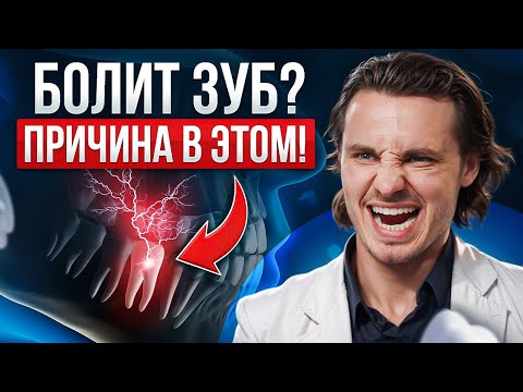 Видео: Не игнорируй ЭТУ боль после стоматолога! Почему болит зуб после лечения?
