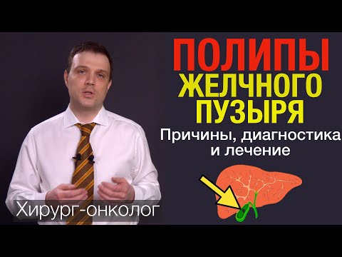 Видео: Полипы желчного пузыря. Симптомы, причины, диагностика, лечение полипов желчного пузыря.