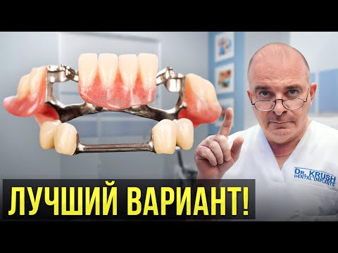 Видео: Зубные протезы НОВОГО ПОКОЛЕНИЯ! Удобно, надежно и недорого