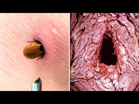 Видео: Вы Не Поверите, Как Под Микроскопом Выглядят Обычные Вещи