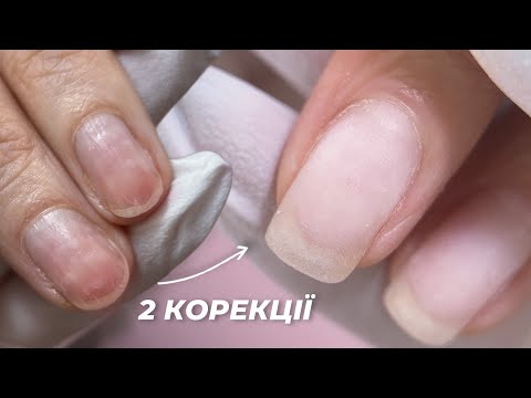 Видео: ПОШКОДЖЕНІ НІГТІ: перетворення у 2 корекції 🤩 НЮАНСИ РОБОТИ | УКРІПЛЕННЯ НІГТІВ ГЕЛЕМ