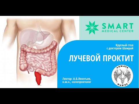 Видео: Лучевой проктит