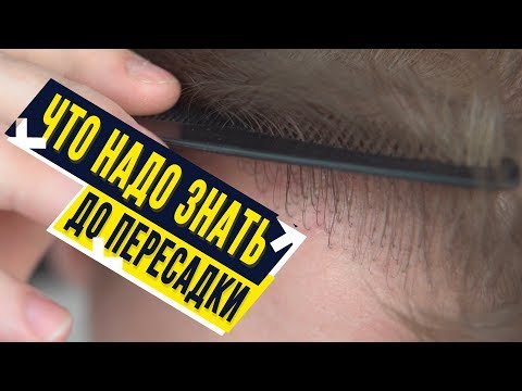 Видео: Что нужно знать до пересадки волос. 1 год после пересадки.