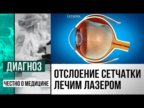 Видео: Невидимая опасность: что такое периферическая дистрофия сетчатки | Диагноз