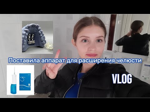 Видео: Установили аппарат для расширения челюсти MSE😬 | Ирригатор Soocas W3 Pro | Влог🎀