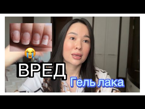 Видео: Вред ГЕЛЬ ЛАКА или как остаться без ногтей ! ЛЕЧЕНИЕ ОНИХОЛИЗИСА 😱