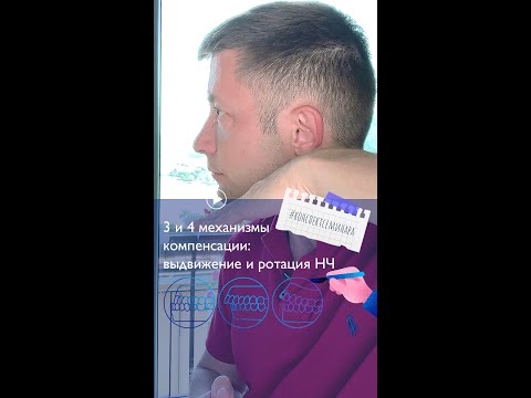 Видео: 4. 3 и 4 механизмы компенсации: выдвижение и ротация нижней челюсти | #конспектсеминара
