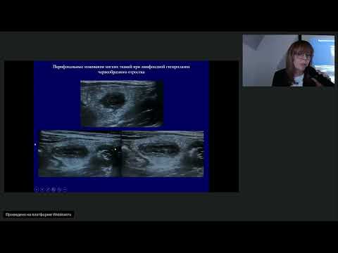 Видео: МНПК для врачей. Актуальные вопросы ультразвуковой диагностики: дайджест.