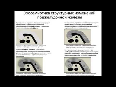 Видео: Эхосемиотика эхоструктурных изменений поджелудочной железы