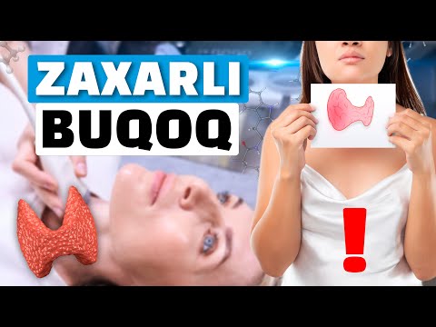 Видео: ҚАЛҚОНСИМОН БЕЗ БУЗИЛИШИ, БЎҚОҚ КАСАЛЛИГИДАН ҚАНДАЙ ХАЛОС БЎЛИШ МУМКИН?