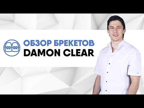 Видео: Сапфировые эстетические самолигирующиеся пассивные брекеты Damon Clear (Ormco - США).