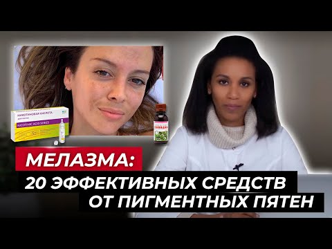 Видео: Как избавиться от мелазмы?// Лучшие средства от пигментации //Избавься от пигментных пятен