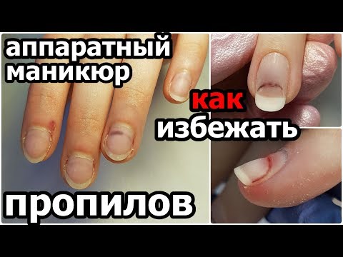 Видео: Аппаратный маникюр. КАК ИЗБЕЖАТЬ ПРОПИЛОВ. Работа с "мясистой" кутикулой, ранами и заусенцами.