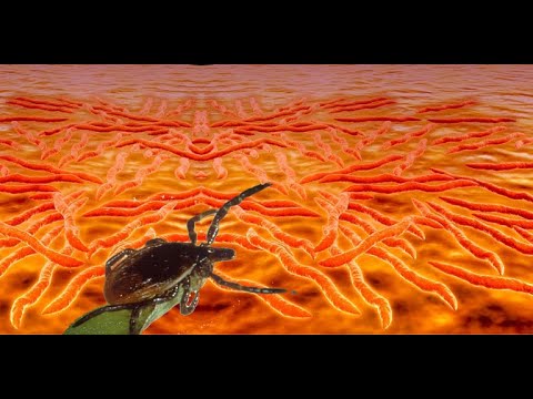 Видео: Клещевой боррелиоз болезнь лайма у кошек и собак симптомы диагностика лечение