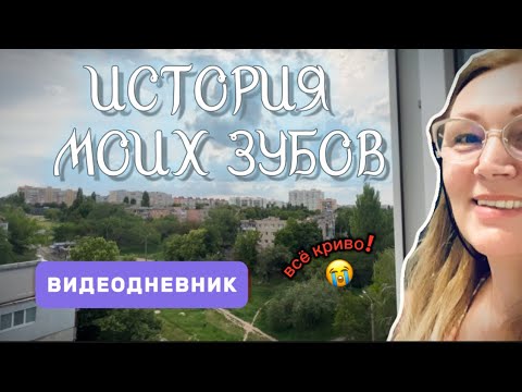 Видео: Нашла СТАРЫЕ ФОТО ЗУБОВ и заплакала… КРИВЫЕ КОРОНКИ  спустя 2 года 🥺