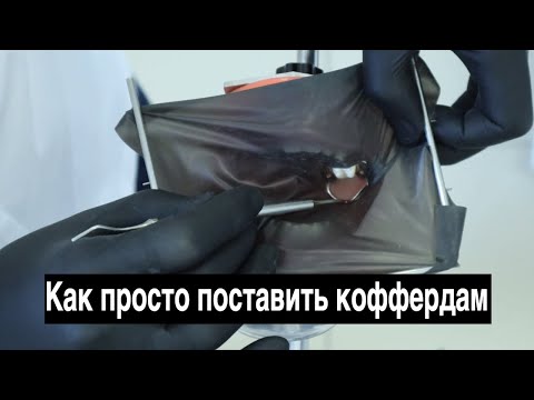 Видео: Самые простые способы поставить коффердам. Изоляция в стоматологии