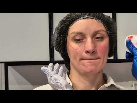 Видео: Radiesse. Канюля.