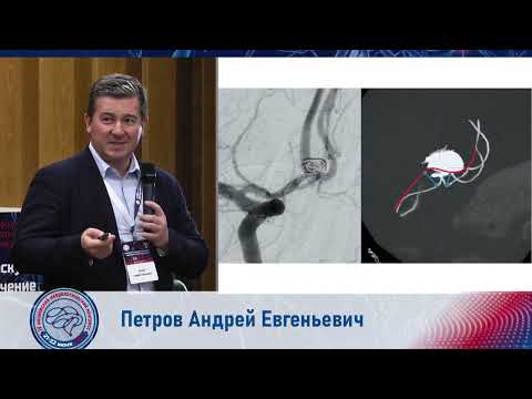 Видео: Лечение аневризм головного мозга с применением программ ангиографических систем.