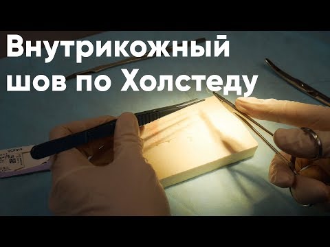 Видео: Внутрикожный шов по Холстеду (косметический шов)