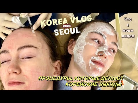 Видео: ВЛОГ ИЗ СЕУЛА. Топовые Процедуры в Корейской Косметологии #жизньвкорее