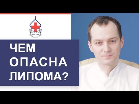 Видео: 🔎 Что такое липома и как ее лечить. Липома что такое. ГКБ №29 им. Баумана. 12+