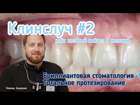 Видео: Тотальное протезирование зубов. Кейс, который войдет в историю! Клинслуч №2