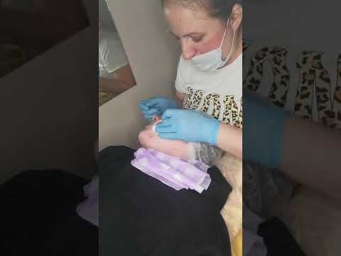 Видео: будем делать чистку механическую) #чисткамеханическая#мальчик#пенза