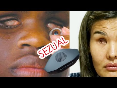 Видео: КАК ОНИ ВИДЯТ БЕЗ ГЛАЗ. SEZUAL