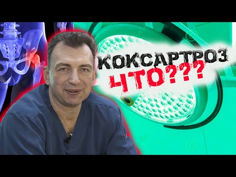 Видео: ЧТО ТЫ НЕ ЗНАЛ ПРО КОКСАРТРОЗ ?