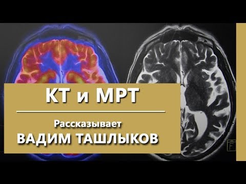 Видео: Что лучше МРТ или КТ при психиатрической диагностике? В чем разница между МРТ и КТ. Israclinic.