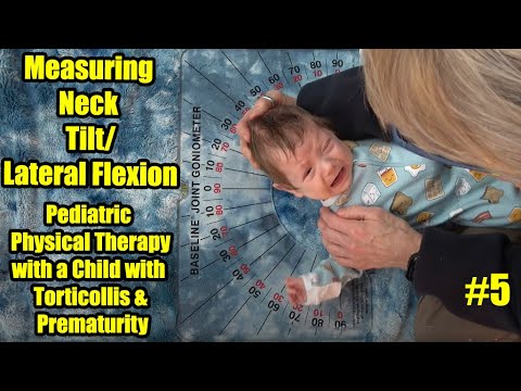 Видео: #5 Измерение наклона/латерального сгибания шеи: терапия ребенка с кривошеей и недоношенностью