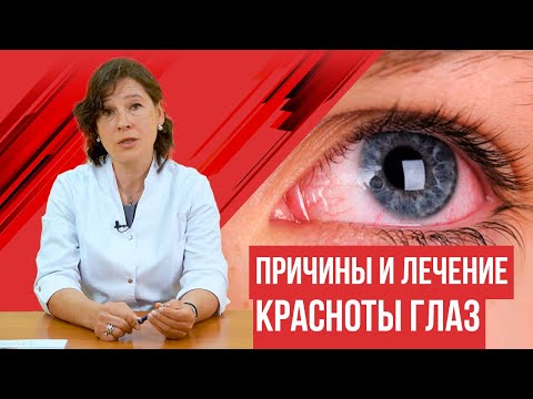 Видео: Покраснение глаз. Причины и лечение красноты глаз.