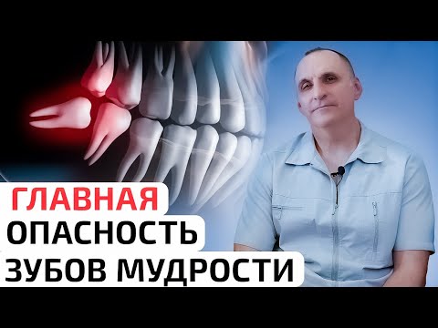 Видео: Главная опасность зубов мудрости