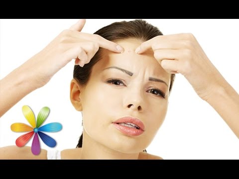 Видео: Как избавиться от прыщей за 15 минут! – Все буде добре