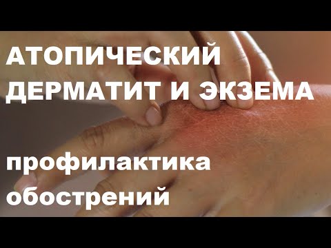 Видео: Эллинский Д.О. Атопический дерматит и экзема у взрослых: профилактика обострений. 23.09.2022