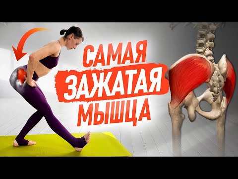 Видео: Перекос таза, косточка на большом пальце ноги, гиперлордоз, х-образные колени и всё из-за ЭТОЙ мышцы