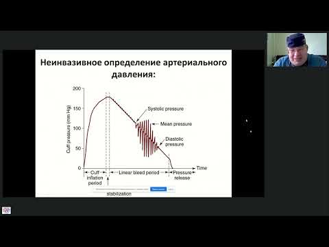 Видео: Мониторинг ГД при ЭКДТ Афончиков В.С.