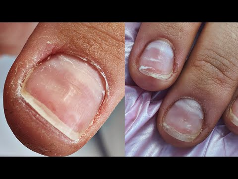 Видео: ЯМЫ НА НОГТЯХ🤒🤧СТЕКЛЯННЫЕ НОГТИ