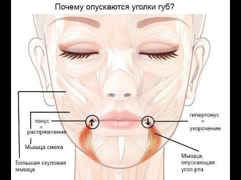 Видео: Как поднять уголки губ? Два упражнения.