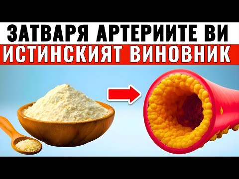Видео: 5-те бели храни, които НАЙ-МНОГО запушват артериите ви и вдигат кръвното (Номер 1 е отрова)