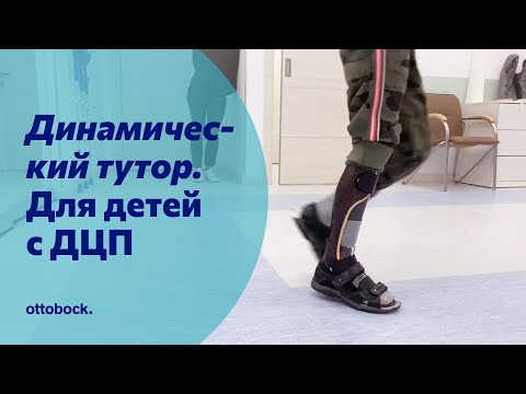 Видео: Динамический тутор при спастической диплегии у детей с ДЦП