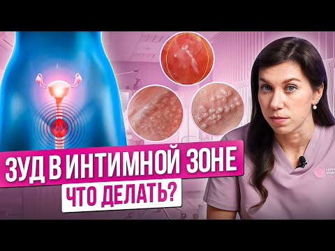 Видео: Зуд половых губ и влагалища. Как избавиться от зуда в интимной зоне у женщины Как снять зуд с вульвы
