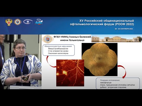 Видео: Т. Д. Охоцимская. Лазерное лечение диабетической ретинопатии: вчера, сегодня, завтра.