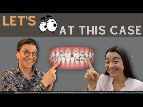 Видео: Как составить план лечения Invisalign ClinCheck?