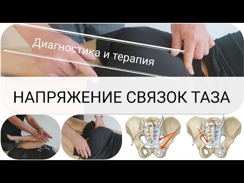 Видео: Боль в паховой области / Напряжение связок таза/ Диагностика и терапия/ Pelvic ligaments